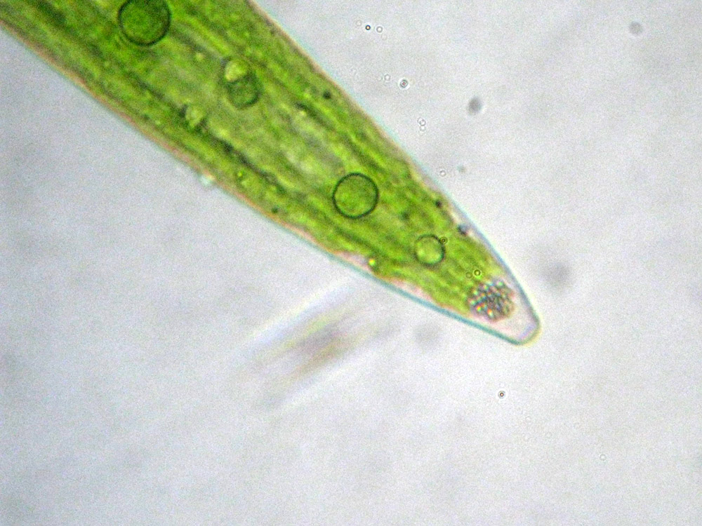 Forse Closterium acerosum